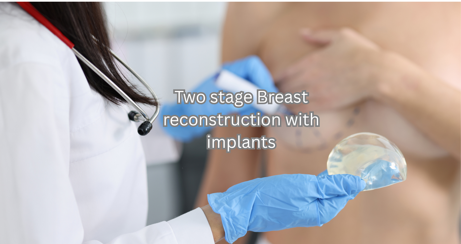implant based breast reconstruction