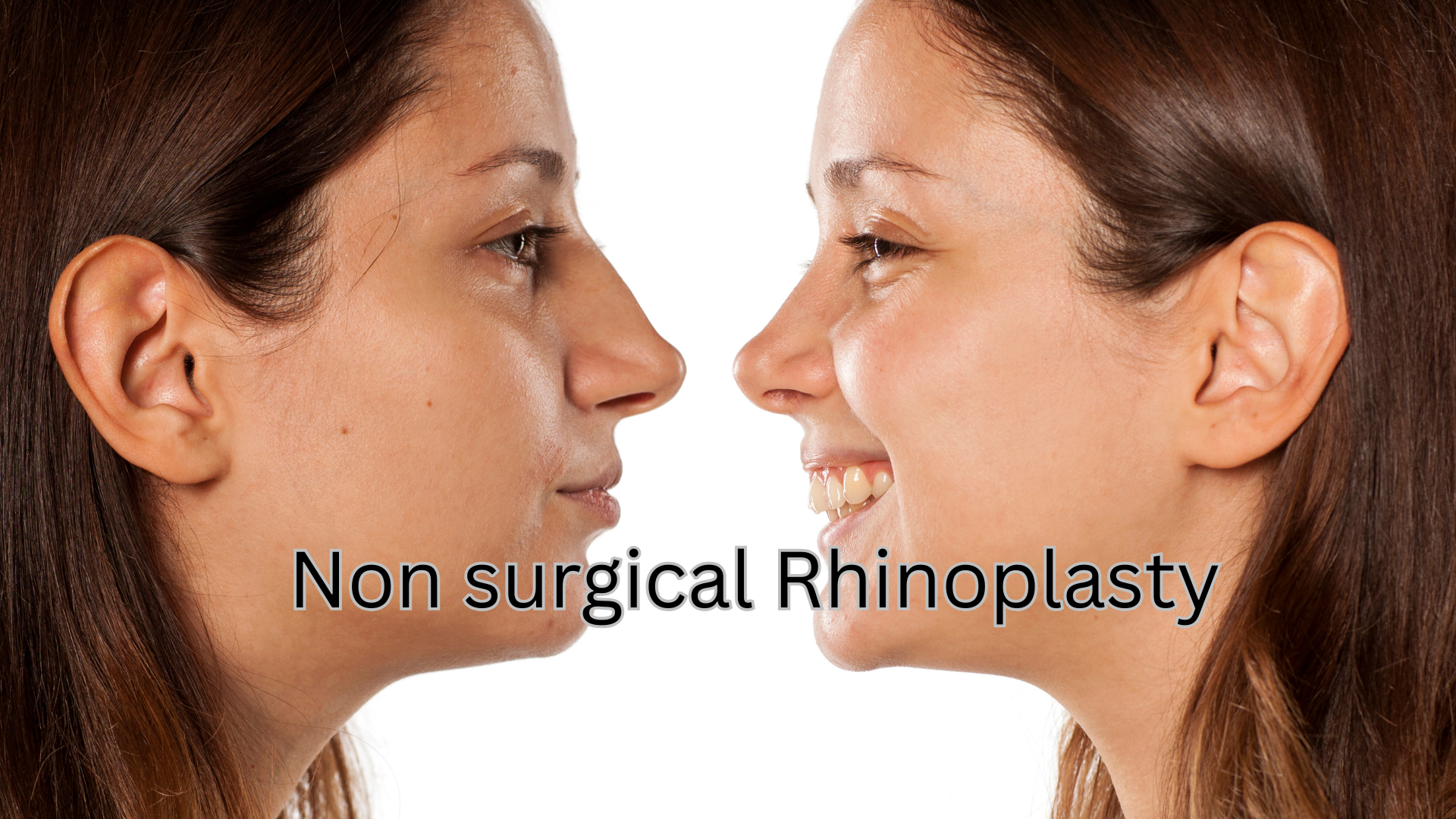 non surgical rhinoplasty